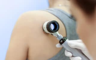 Can Skin Cancer Be Linked to 9-11 Exposure portrayed by skin cancer diagnosis
