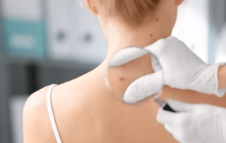 9/11 melanoma Victim Compensation Fund claims attorney at Weisfuse & Weisfuse, LLC