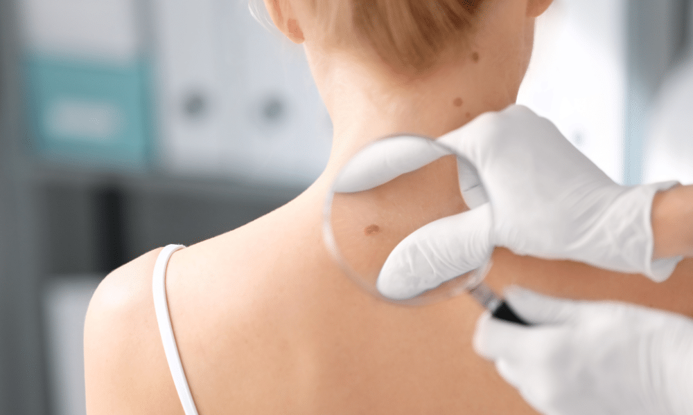 9/11 melanoma Victim Compensation Fund claims attorney at Weisfuse & Weisfuse, LLC